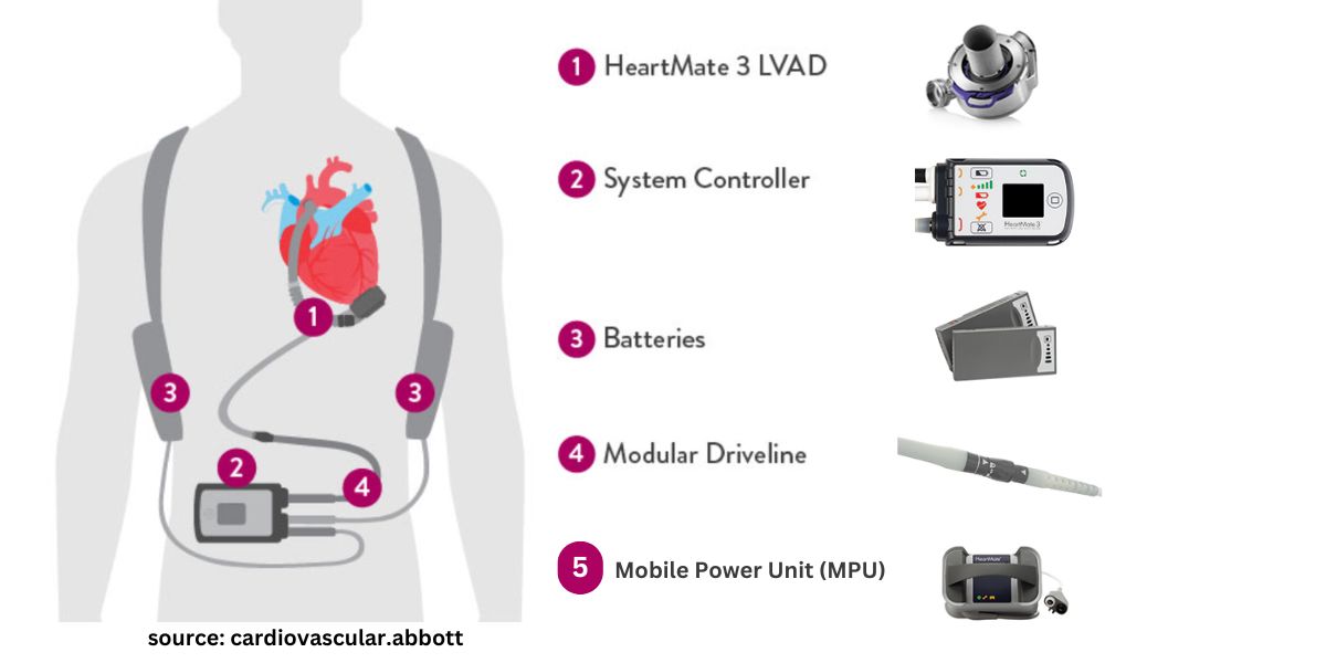 HeartMate 3 LVAD